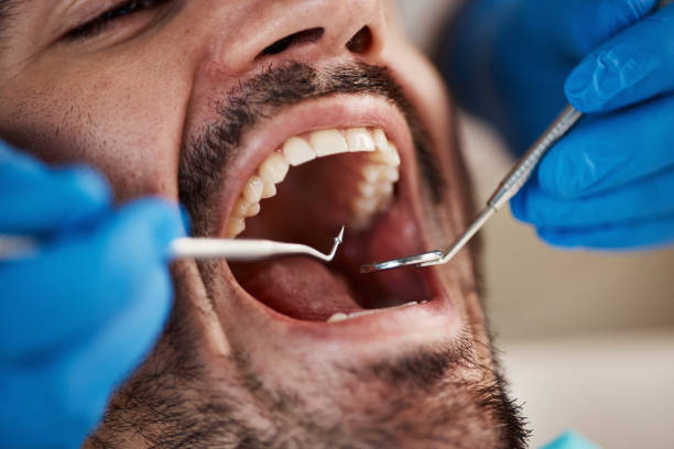 Best Urgent Tooth Repair  in Abbeville, GA
